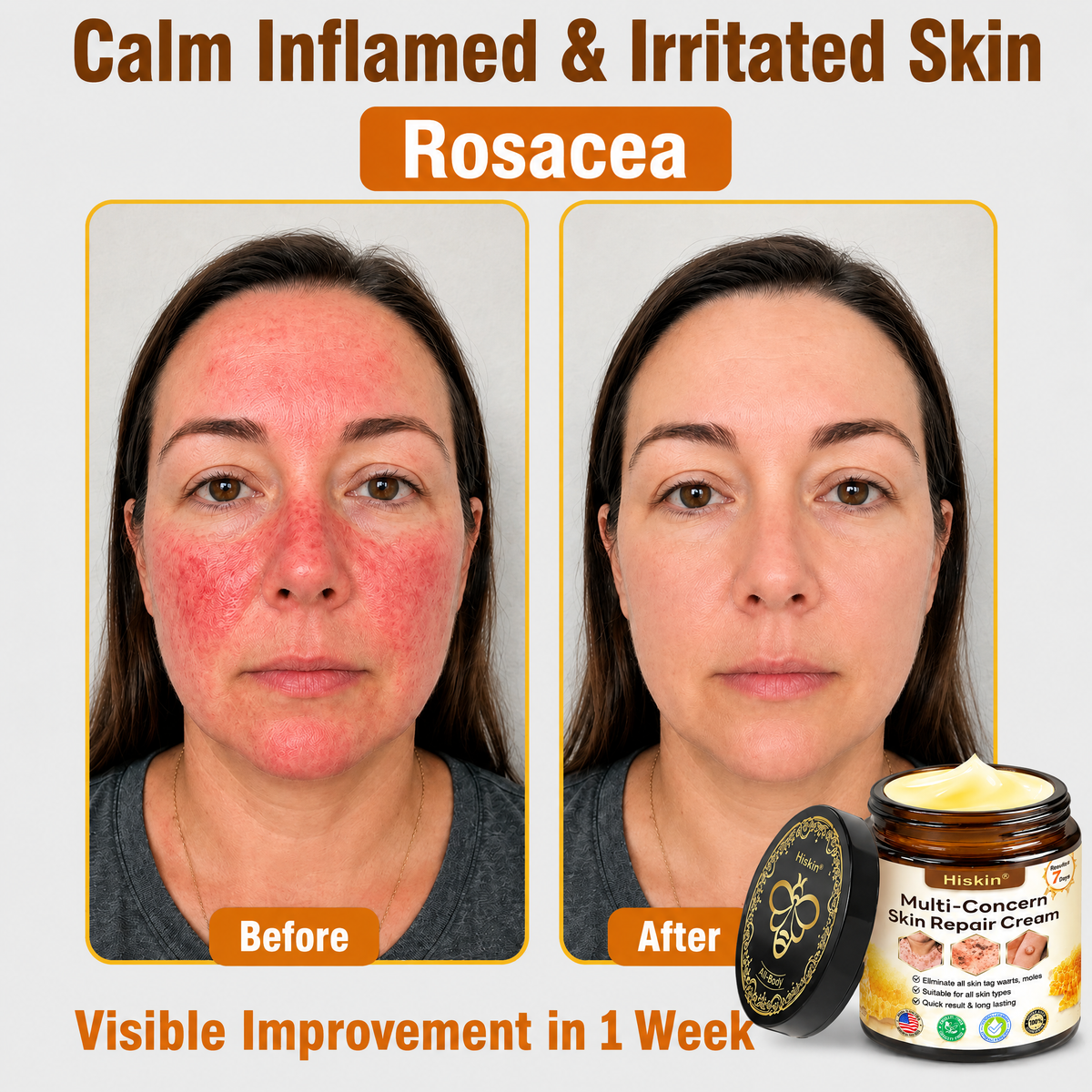 ✨HISKIN® Multi-Concern Skin Repair Cream (One powerful cream to repair inflammation, dryness, aging, pigmentation, and visible skin damage.)