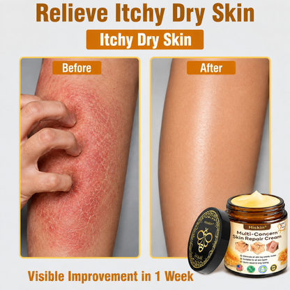 ✨HISKIN® Multi-Concern Skin Repair Cream (One powerful cream to repair inflammation, dryness, aging, pigmentation, and visible skin damage.)